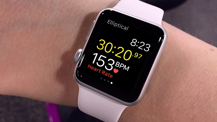 Un Apple Watch salva un uomo da una embolia polmonare