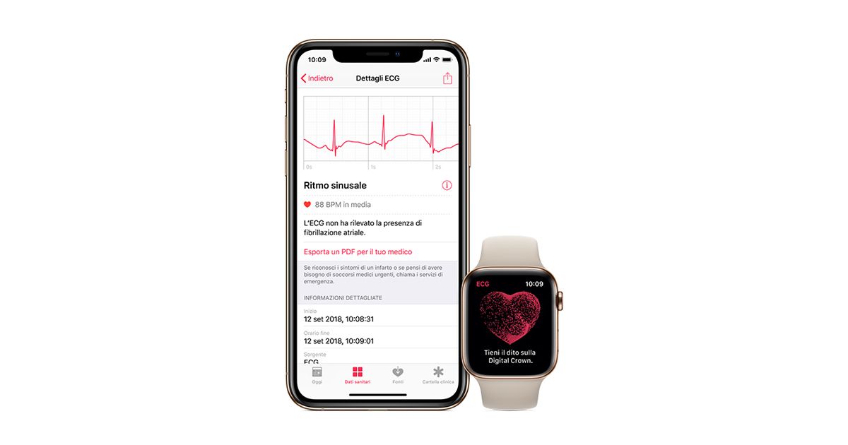 L’app ECG di Apple Watch arriverà in Brasile e Giappone