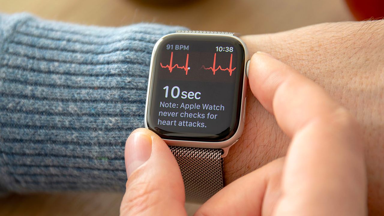 L’ECG di Apple Watch funzionerà con frequenze cardiache fino a 150 BPM